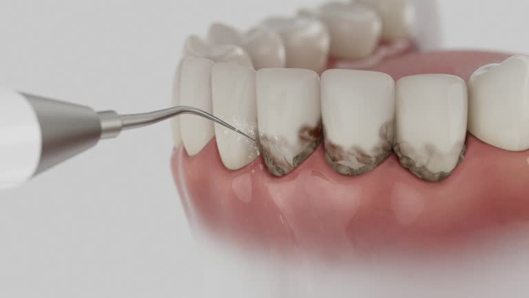Trusted Wisdom Tooth Removal service in Alamosa East, CO - Dentist Open Now